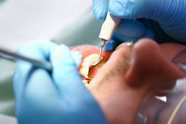 Best Emergency Dentist for Knocked-Out Tooth in Watsontown, PA
