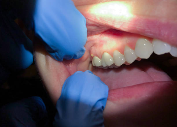 Best Mobile Emergency Dentist in Watsontown, PA